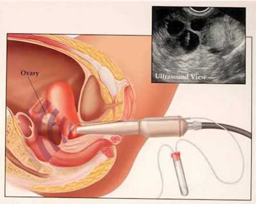 专业助孕机构推荐：全方位服务助您圆梦